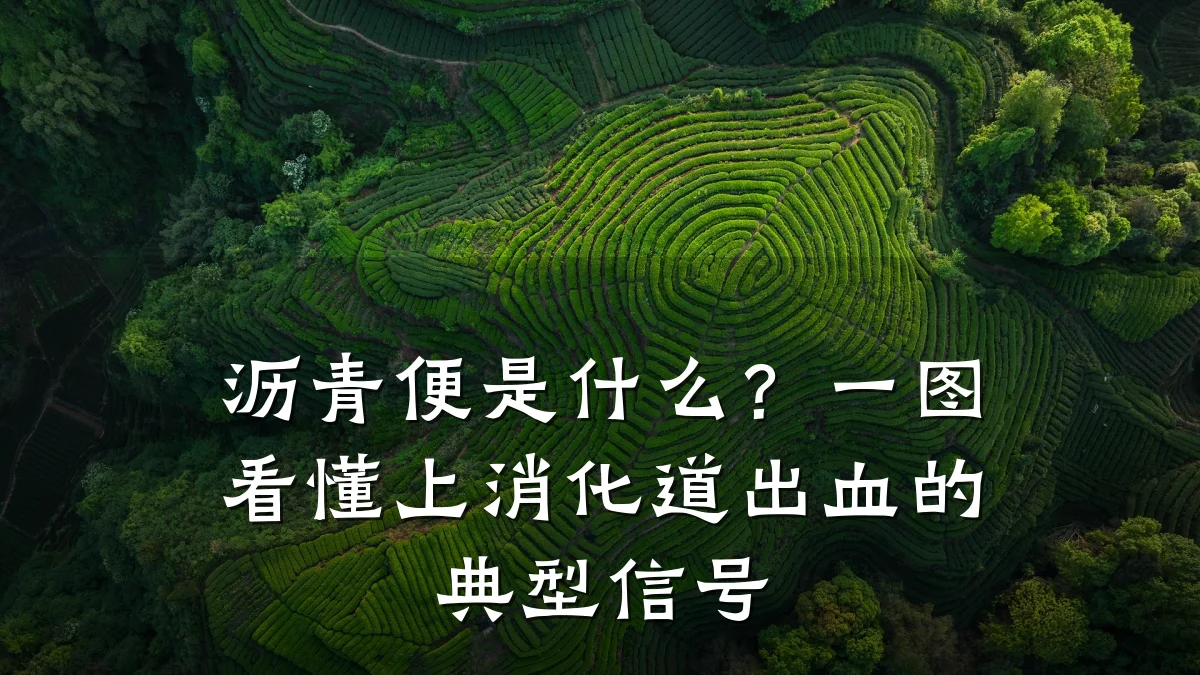 沥青便是什么?一图看懂上消化道出血的典型信号
